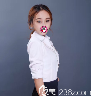 北京藝美整形埋線雙眼皮案例 北京藝美整形埋線雙眼皮案例