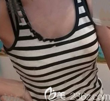 呼和浩特張高貴醫(yī)療美容門診部張高貴術(shù)前照片1