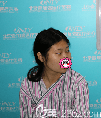 張曉亮醫(yī)生準(zhǔn)備給我做設(shè)計前照 張曉亮醫(yī)生準(zhǔn)備給我做設(shè)計前照