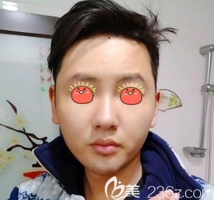 杭州薇琳脂肪填充<span style= 杭州薇琳脂肪填充<span style=