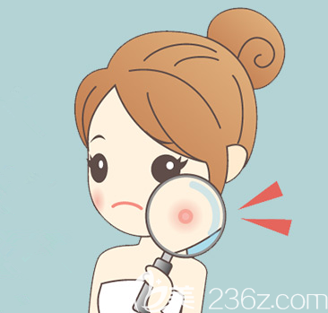 臉部長(zhǎng)痘示意圖