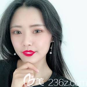 馮艷中醫(yī)生為我做自體脂肪填充面部術(shù)后28天面部飽滿(mǎn)立體 馮艷中醫(yī)生為我做自體脂肪填充面部術(shù)后28天面部飽滿(mǎn)立體