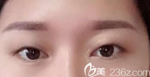 我沒去景德鎮(zhèn)藝美割雙眼皮前的素顏照片 我沒去景德鎮(zhèn)藝美割雙眼皮前的素顏照片