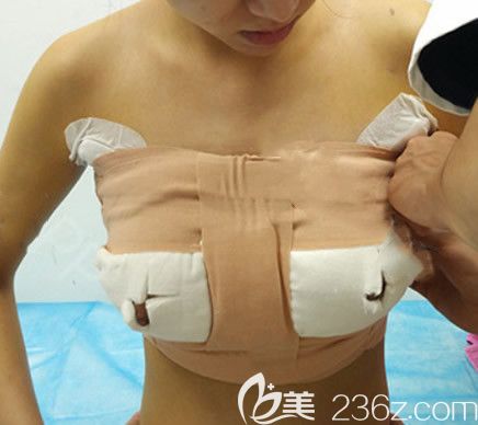 華美王金紅假體隆胸術(shù)后即刻效果 華美王金紅假體隆胸術(shù)后即刻效果