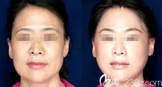 包頭葉子吉志俊做線雕怎么樣