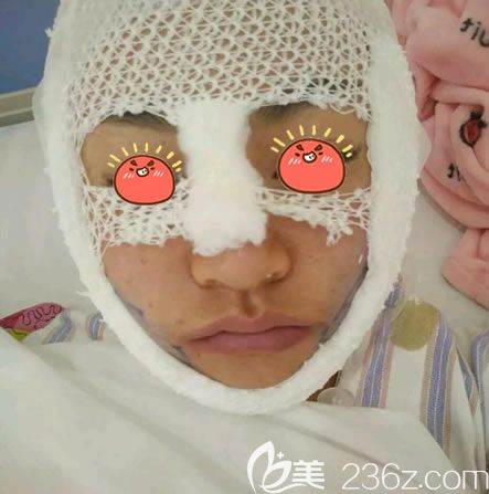 永康光大持久V臉術(shù)即刻效果