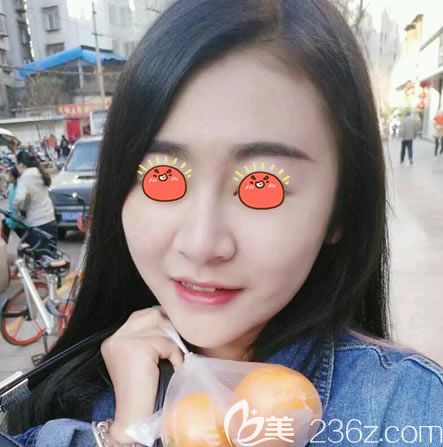 這是一份我在永康光大整形醫(yī)院做過光纖溶脂瘦臉的體驗(yàn)報(bào)告,希望不要反彈效果能持久