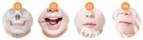 韓國MVP人中縮短術(shù)