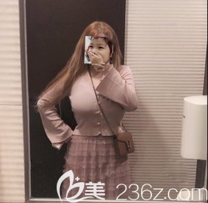 腰腹吸脂術(shù)后又做了面部吸脂+手臂吸脂