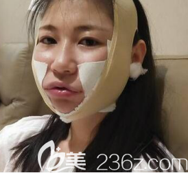 手術(shù)當(dāng)天 手術(shù)當(dāng)天