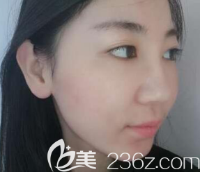 拆過(guò)線以后 拆過(guò)線以后