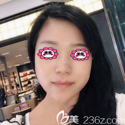 埋線提升第15天<span style=