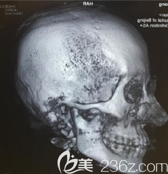 韓國(guó)本愛(ài)做輪廓怎么樣 韓國(guó)本愛(ài)做輪廓怎么樣