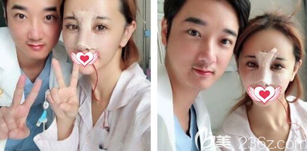 隆鼻失敗修復(fù)第3天沒(méi)有發(fā)現(xiàn)鼻尖紅 隆鼻失敗修復(fù)第3天沒(méi)有發(fā)現(xiàn)鼻尖紅