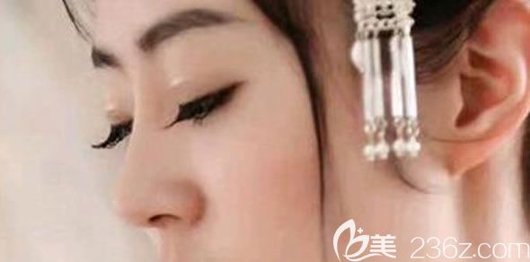 肋軟骨隆鼻30天恢復(fù)的很自然 肋軟骨隆鼻30天恢復(fù)的很自然