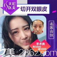 石家莊天宏五月整形又降價(jià)了 雙眼皮優(yōu)惠活動(dòng)價(jià)是1280元、假體隆胸是8800元