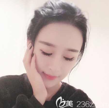 東莞自體脂肪填充哪家醫(yī)院做的好