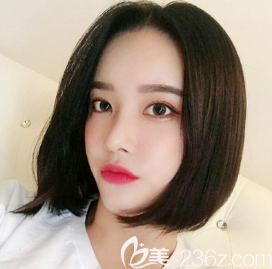 找廣州紫馨曹仁昌做的眼睛修復(fù)兩個月自拍