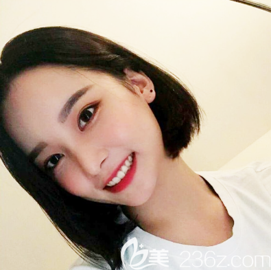 感謝廣州紫馨曹仁昌院長幫我修復(fù)好了眼睛