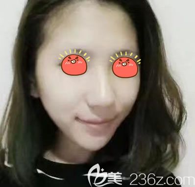 紹興上虞藝美自體脂肪填充<span style=