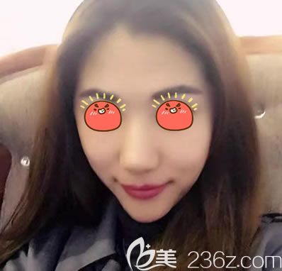 紹興藝美自體脂肪填充<span style=