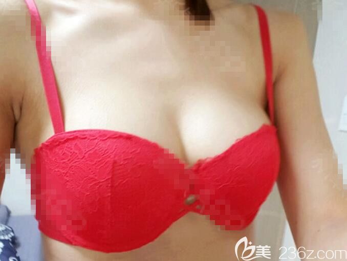 <!--<i data=20240703-sp></i>-->范隆胸怎么樣 <!--<i data=20240703-sp></i>-->范隆胸怎么樣