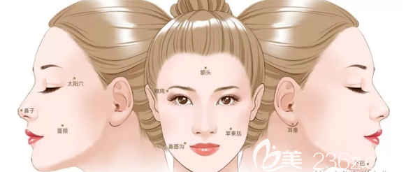 面部自體脂肪移植的部位 面部自體脂肪移植的部位