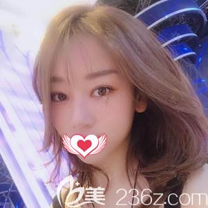 李春雷醫(yī)生為我做眼綜合術(shù)后18天消腫