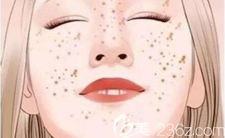 蜂巢皮秒祛斑原理