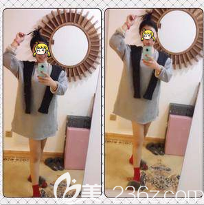 北京米蘭柏羽麗都醫(yī)院注射瘦腿案例 北京米蘭柏羽麗都醫(yī)院注射瘦腿案例