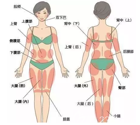 吸脂手術(shù)適合部位