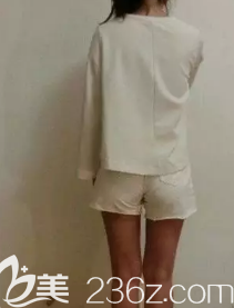 在威海做的大腿吸脂，65CM的腿圍吸脂后瘦到57CM，我是一次就抽了3000CC