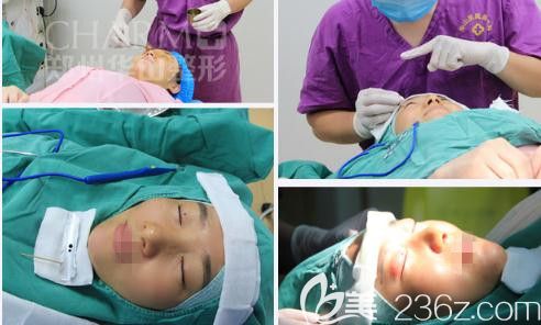 阿爾法美眼術(shù)手術(shù)進(jìn)行時