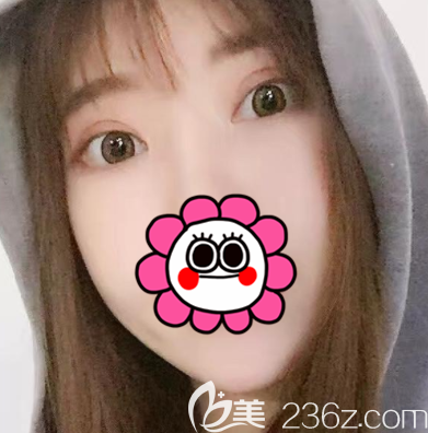 北京壹加壹眼綜合案例 北京壹加壹眼綜合案例