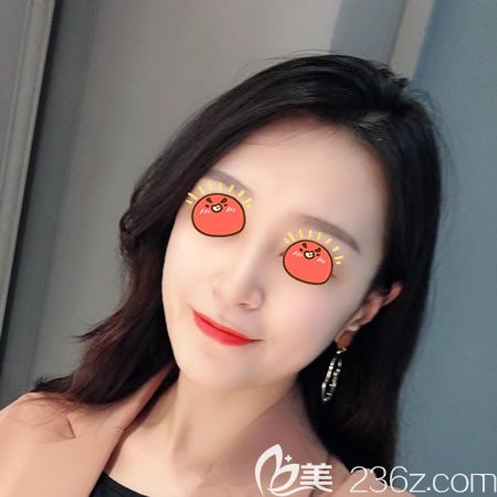 紹興上虞藝美隆鼻<span style=