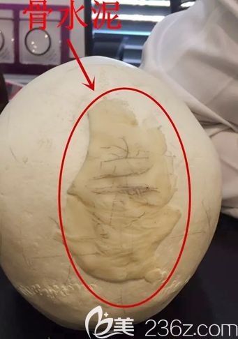 韓國雕刻骨水泥 韓國雕刻骨水泥