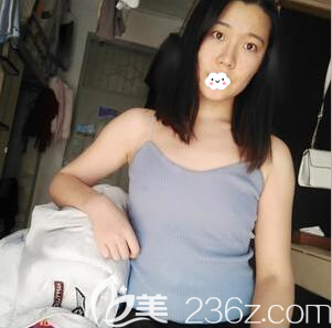 找賴明忠做豐胸手術(shù)前的照片