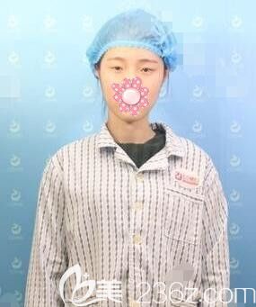 蘇州康美醫(yī)生設計韓式精切雙眼皮手術方案