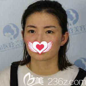 在石家莊藍(lán)山做脂肪填充面部前是大方臉 在石家莊藍(lán)山做脂肪填充面部前是大方臉