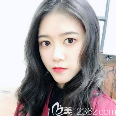 東莞美立方李志剛做脂肪填充怎么樣 東莞美立方李志剛做脂肪填充怎么樣