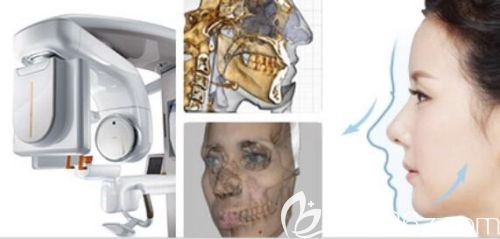 3DCT鼻整形 3DCT鼻整形