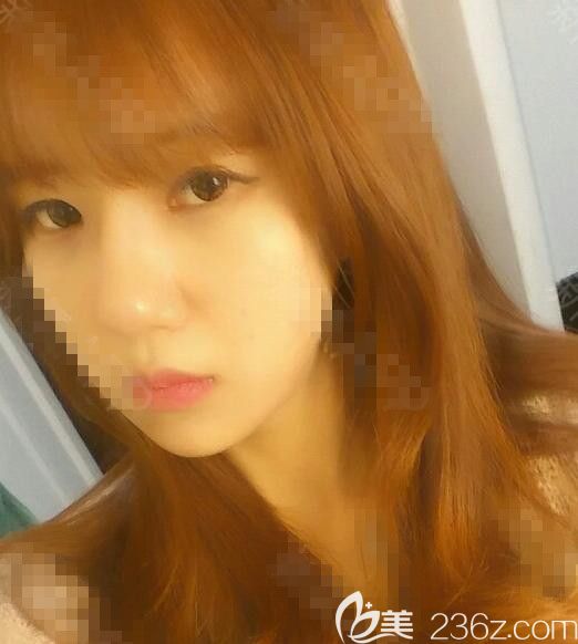 只是在韓國(guó)THE整形外科做了隆鼻為啥感覺自信心爆棚