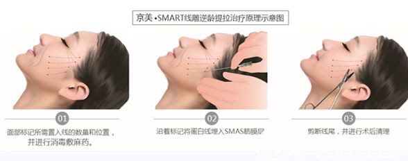 京美蛋白線提拉步驟圖解