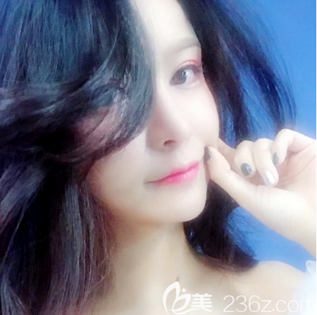 瞧我找深圳隆鼻口碑技術很好的深圳非凡梅夠明做的鼻綜合隆鼻效果怎么樣