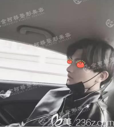 醫(yī)院陳樹科做假體耳軟骨隆鼻鼻子整形手術(shù)案例,記錄一下恢復(fù)的過程