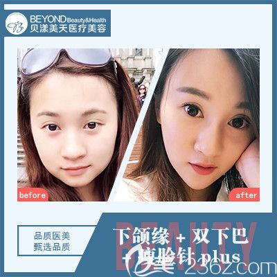 深圳貝漾美天孫音醫(yī)生<span style= 深圳貝漾美天孫音醫(yī)生<span style=