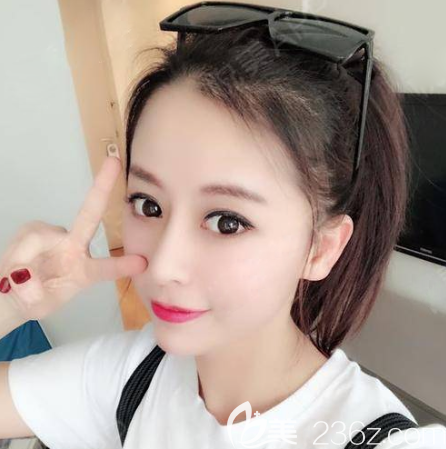 廣州美萊劉豪做鼻子怎么樣 廣州美萊劉豪做鼻子怎么樣