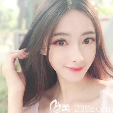 <!--<i data=20240703-sp></i>-->醫(yī)院面部脂肪填充術后一個月