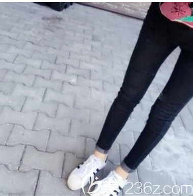 <!--<i data=20240703-sp></i>-->醫(yī)院<!--<i data=20240703-sp></i>-->醫(yī)生大腿吸脂案例 <!--<i data=20240703-sp></i>-->醫(yī)院<!--<i data=20240703-sp></i>-->醫(yī)生大腿吸脂案例