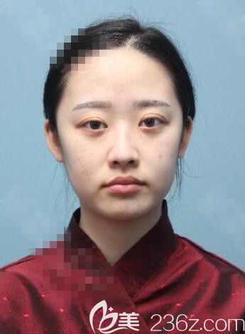 術(shù)前 術(shù)前